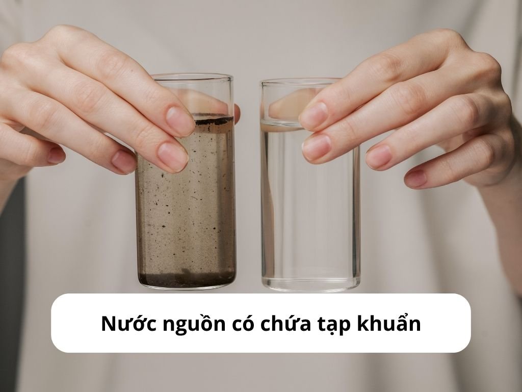Nước nguồn có chứa tạp khuẩn